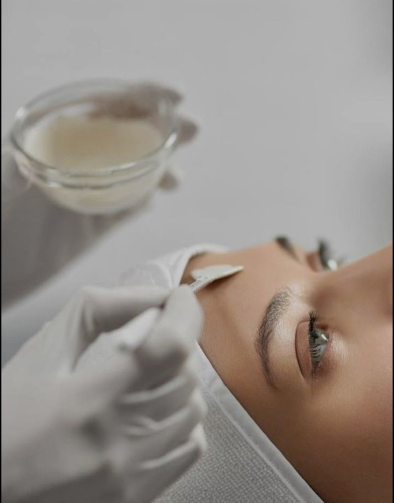 Chemical Peel