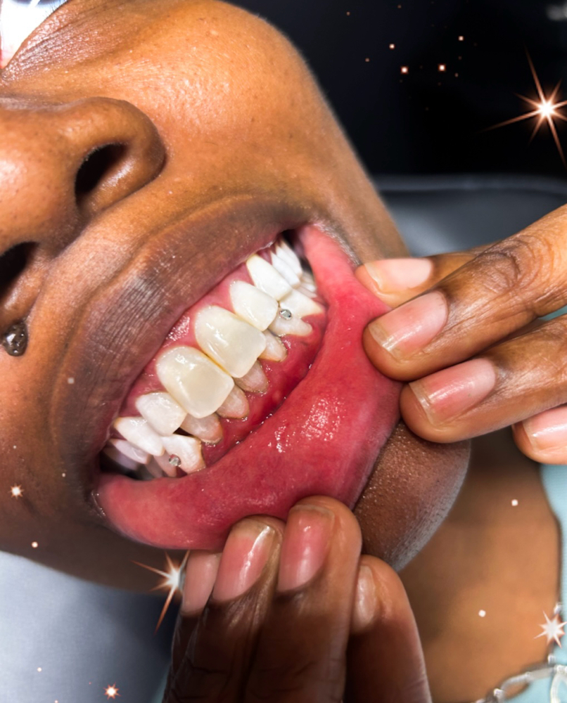 Swarovski Tooth Gems