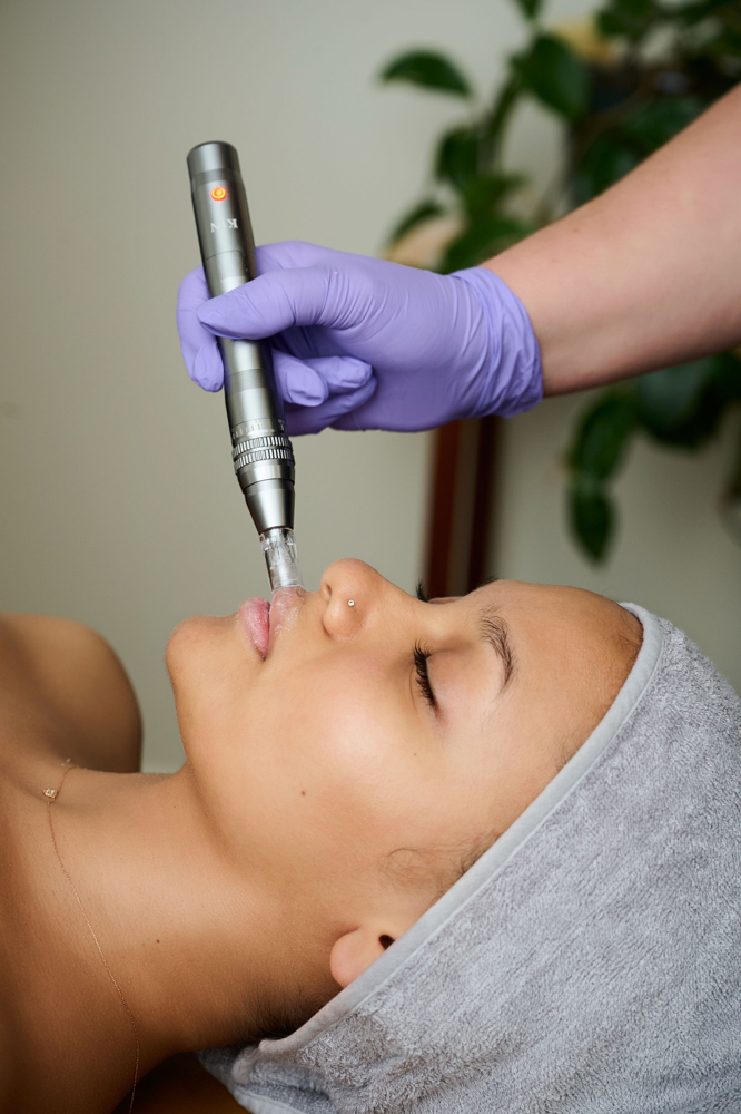 Nano-Infusion Treatment