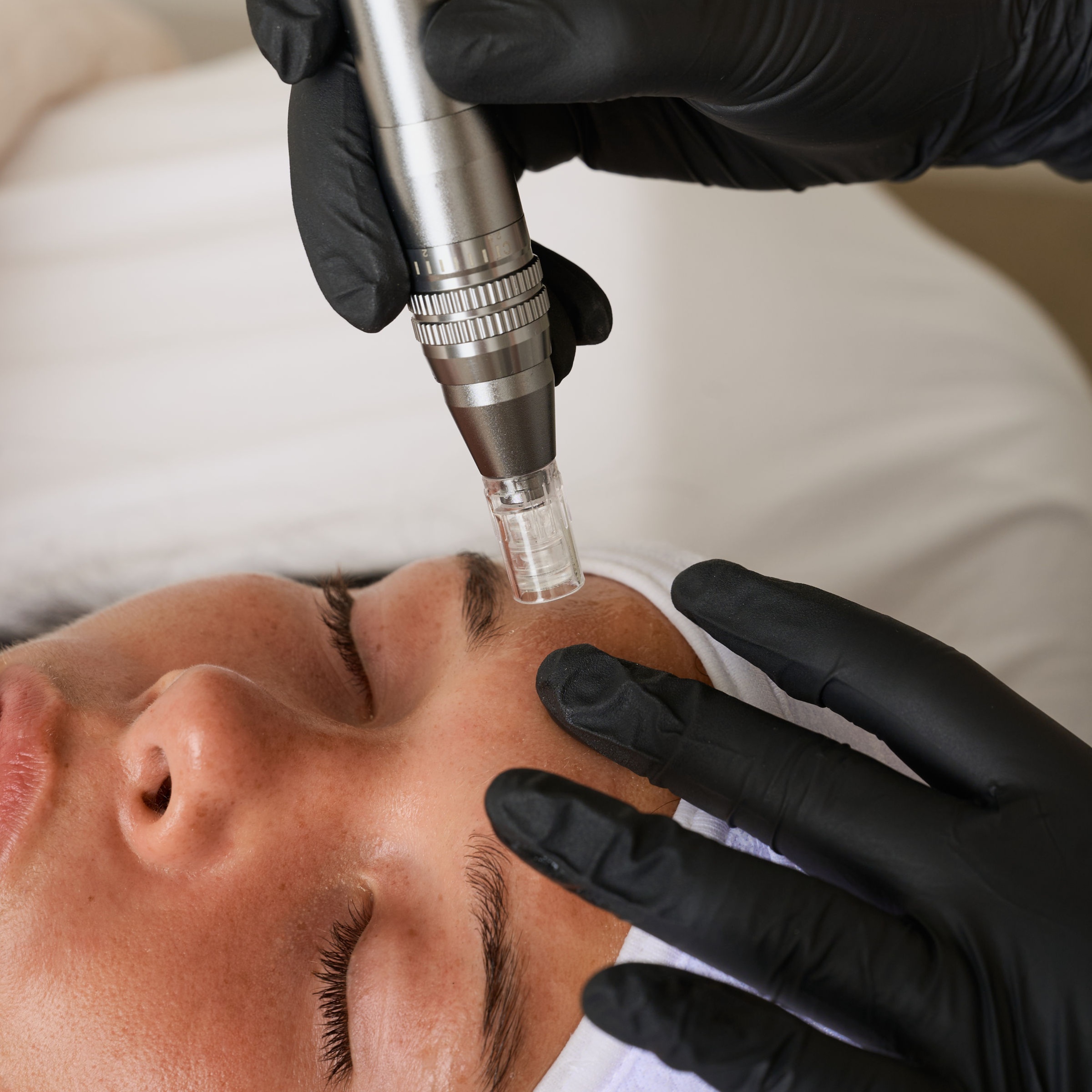 Nano-Infusion Treatment at Woman Of Valor Aesthetics in Hays, KS