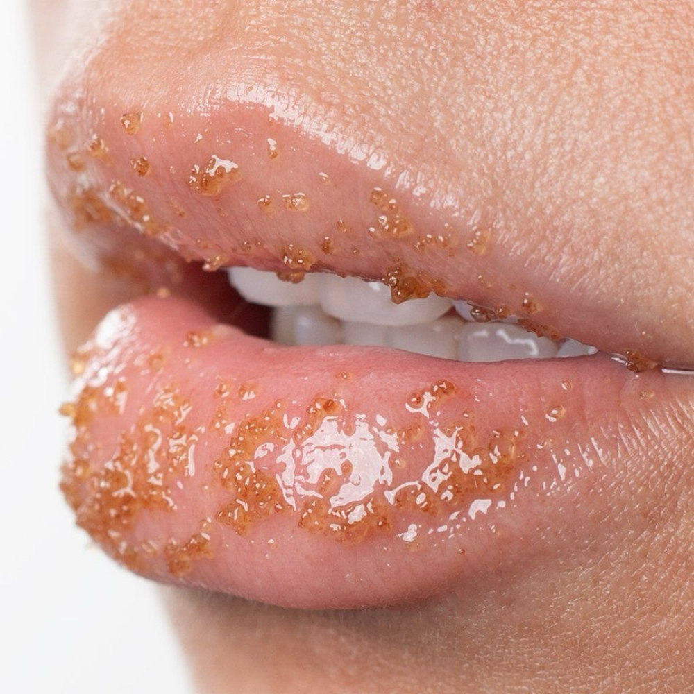 Lip Treatment at Luminous Complexions Esthetics in Oswego, IL