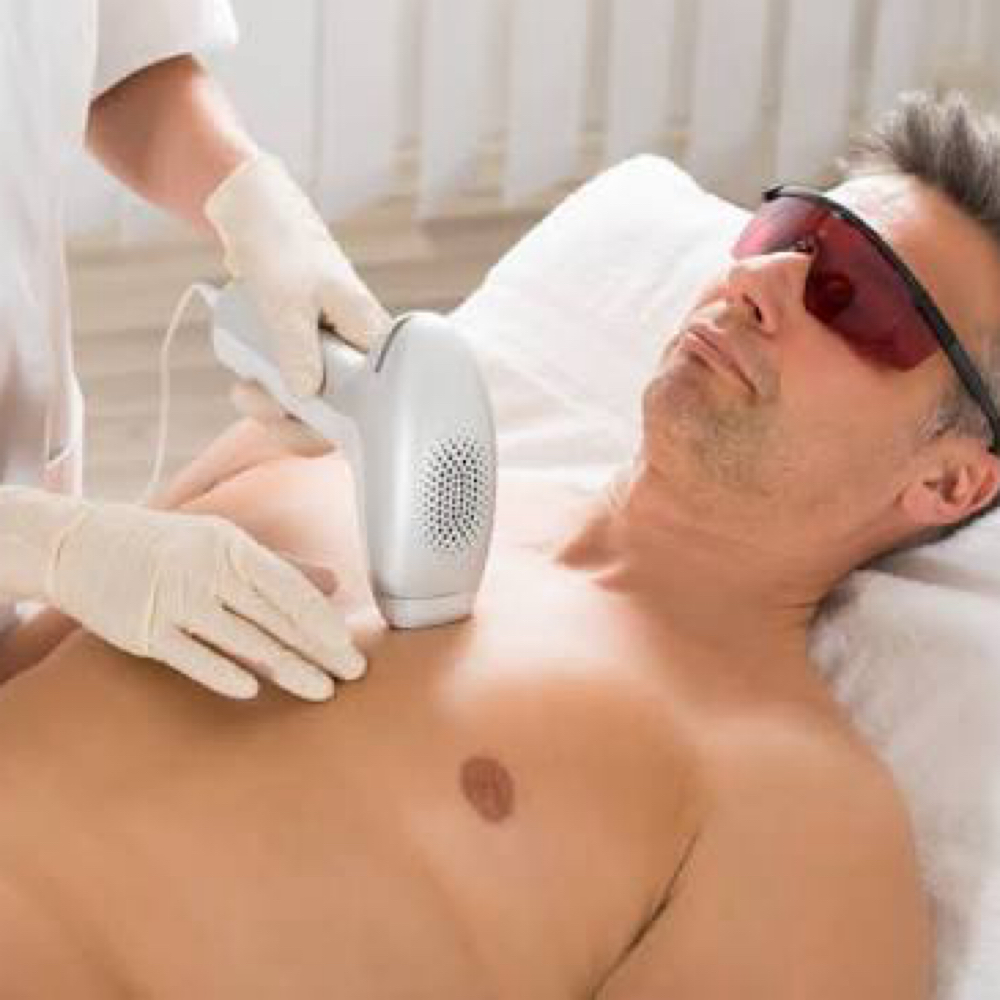 Laser Hair Removal- Chest at Chatuge Med Spa & Fitness in Hiawassee, GA