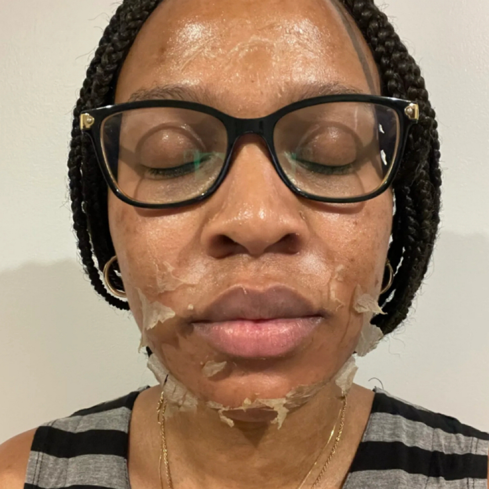 Chemical Peels at The SKN Whisperer in Atlanta, GA