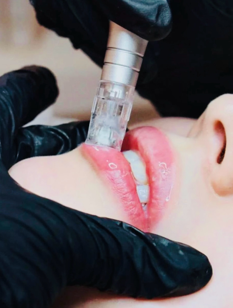 BB GLOW LIP HYDRAPLUMP