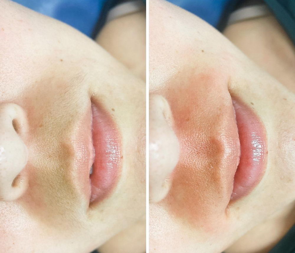 Upper Lip Wax
