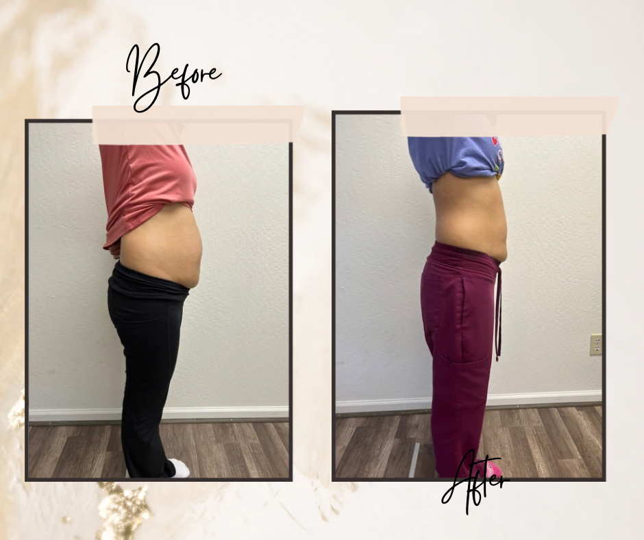 Non-Invasive Body Contour Support at Her Contour & Wellness, LLC in Antioch, CA