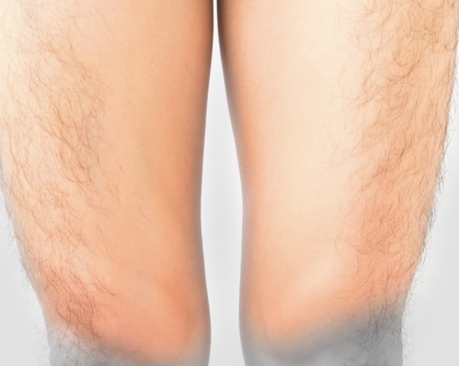 Upper Legs Wax Men