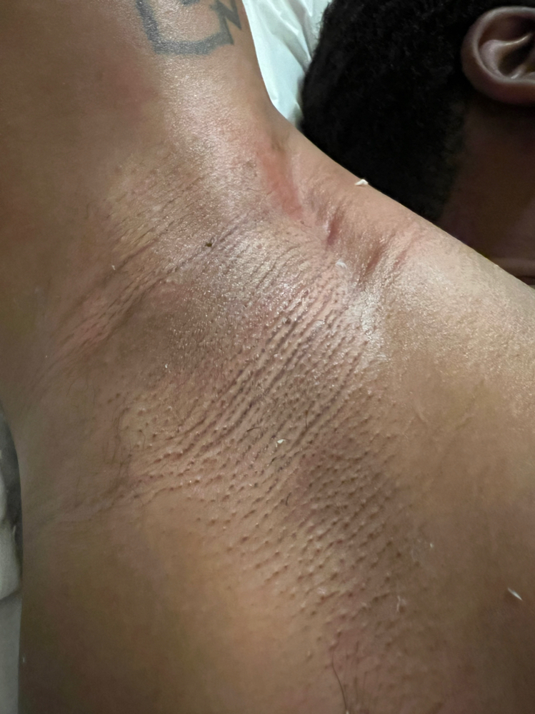 Male Underarm Wax