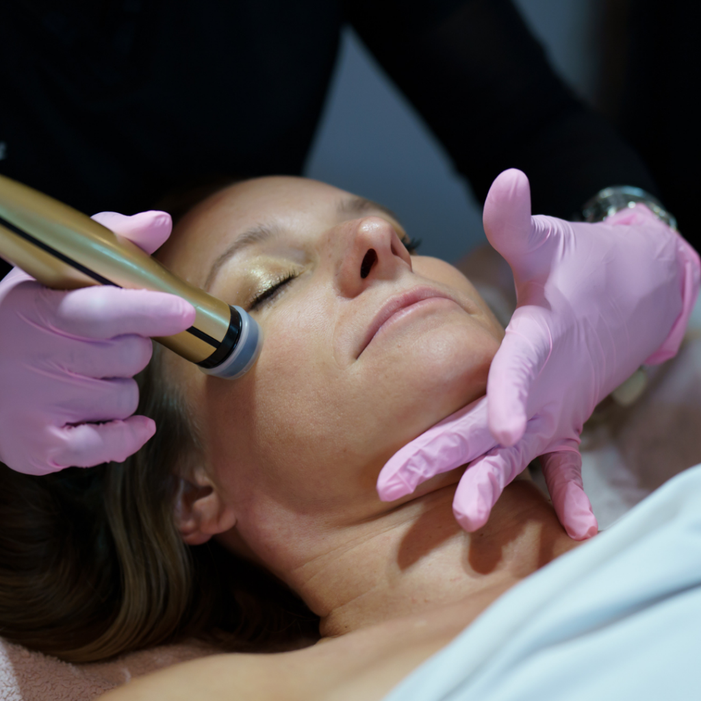 Epifusion Needle-Free Needling