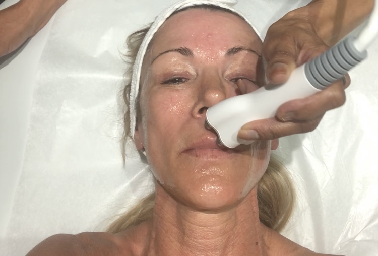 Skin Tightening Treatment - Face