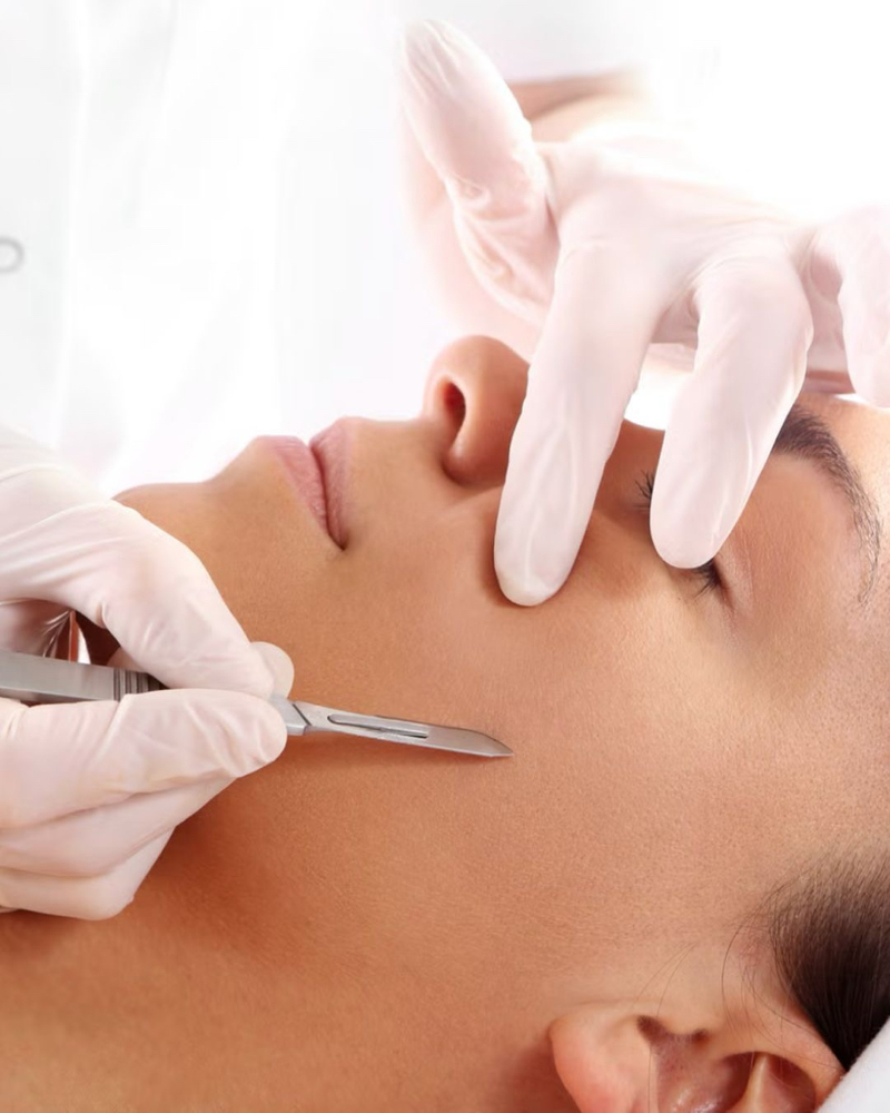 Dermaplane Facial