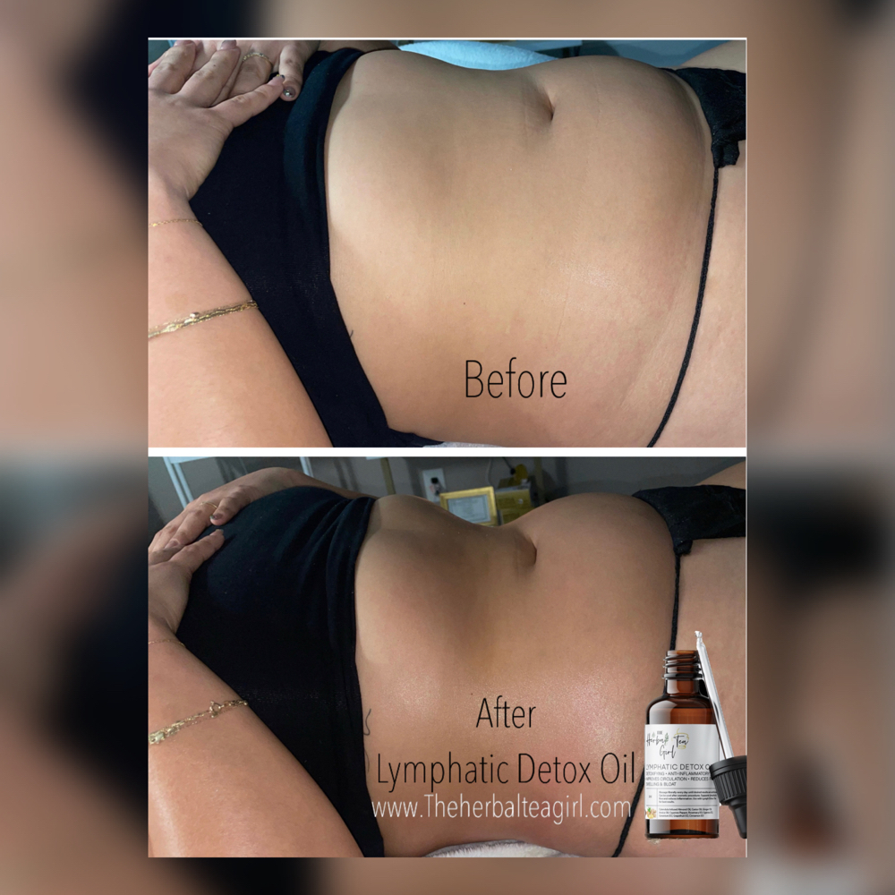 Brazilian Body Detox Contouring