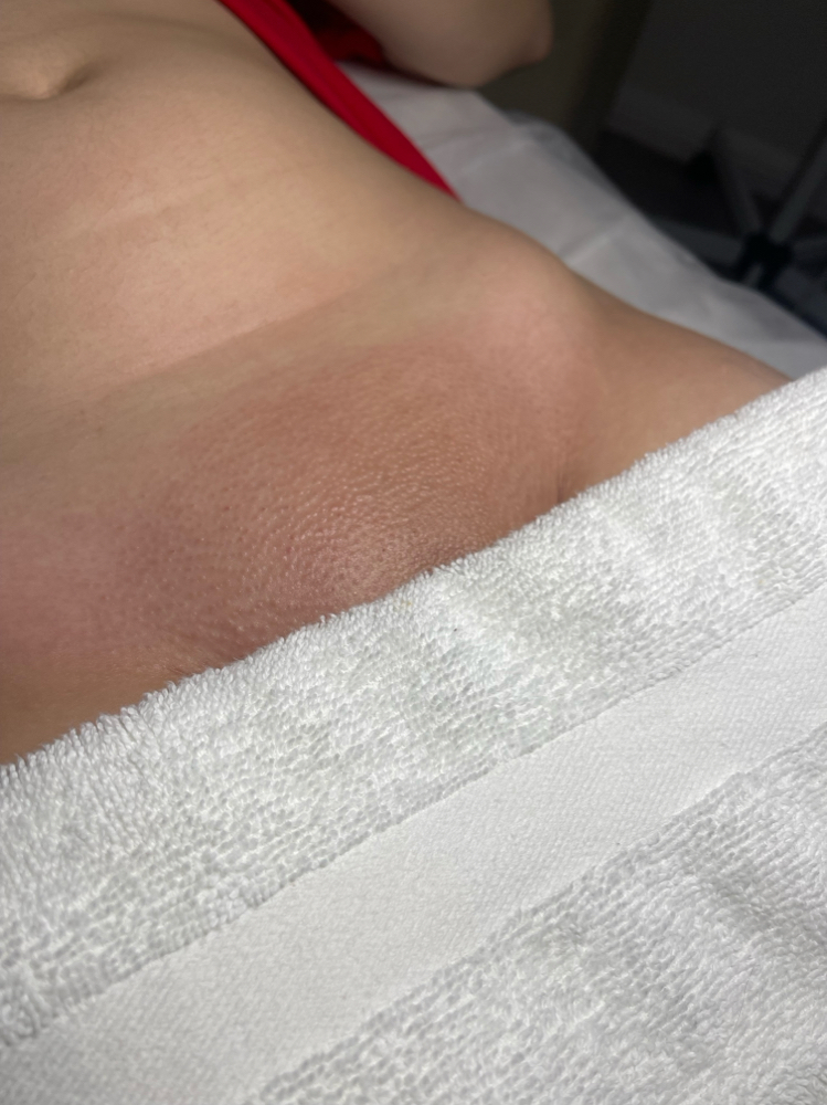 Brazilian Wax