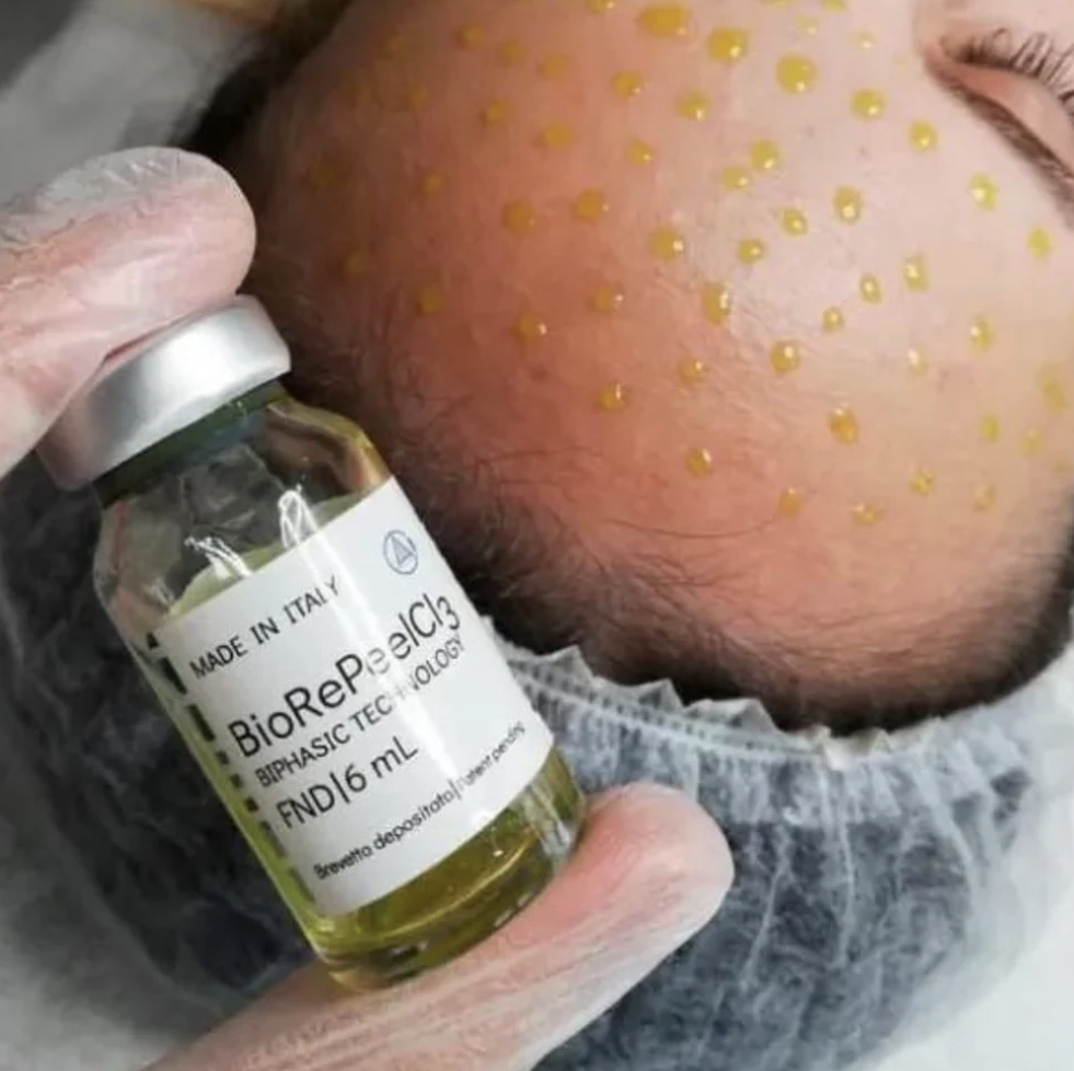 BioRePeel CL3 Chemical Peel (Face)