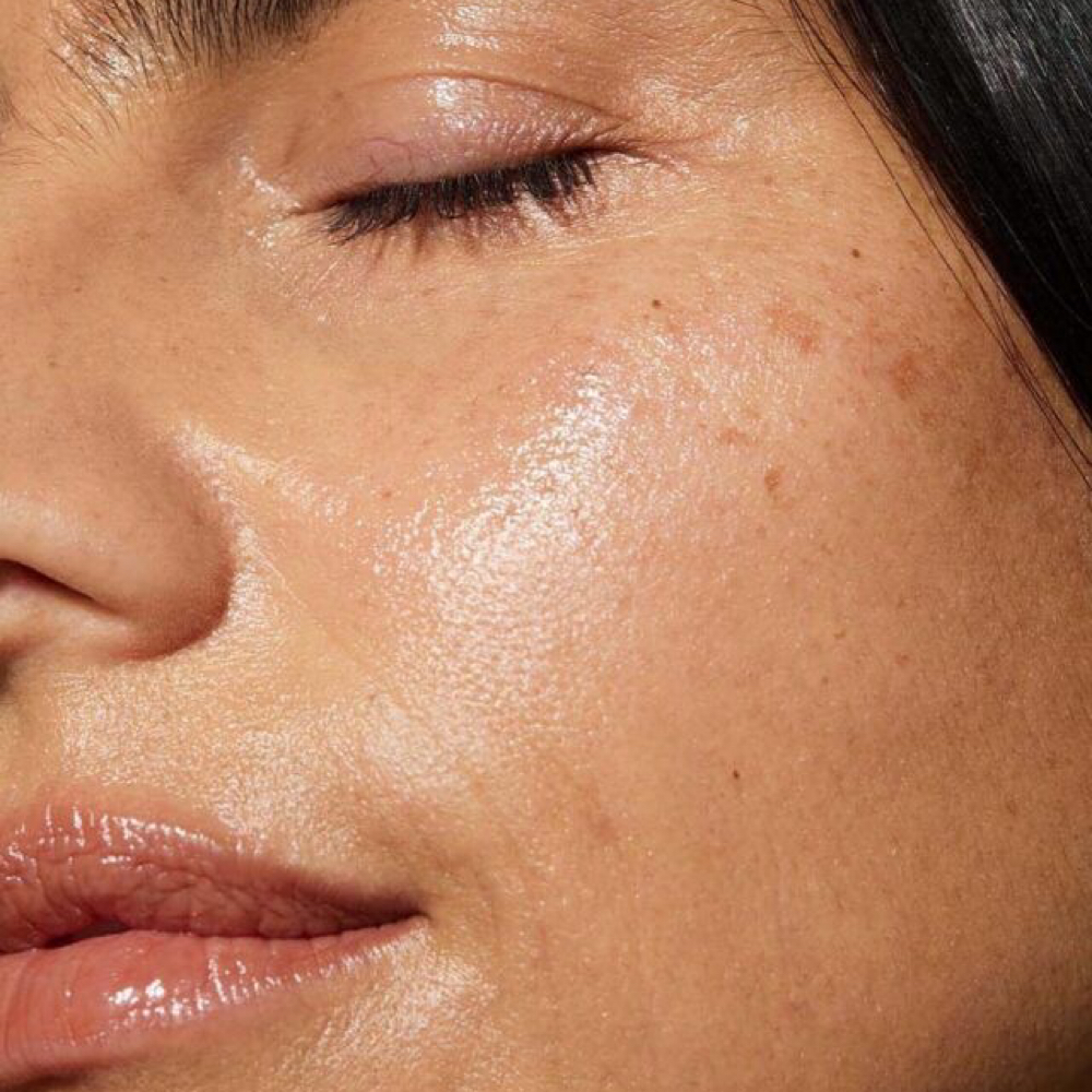 Dermaplaining + Enzyme Facial at SKINSMITH in Tyler, TX