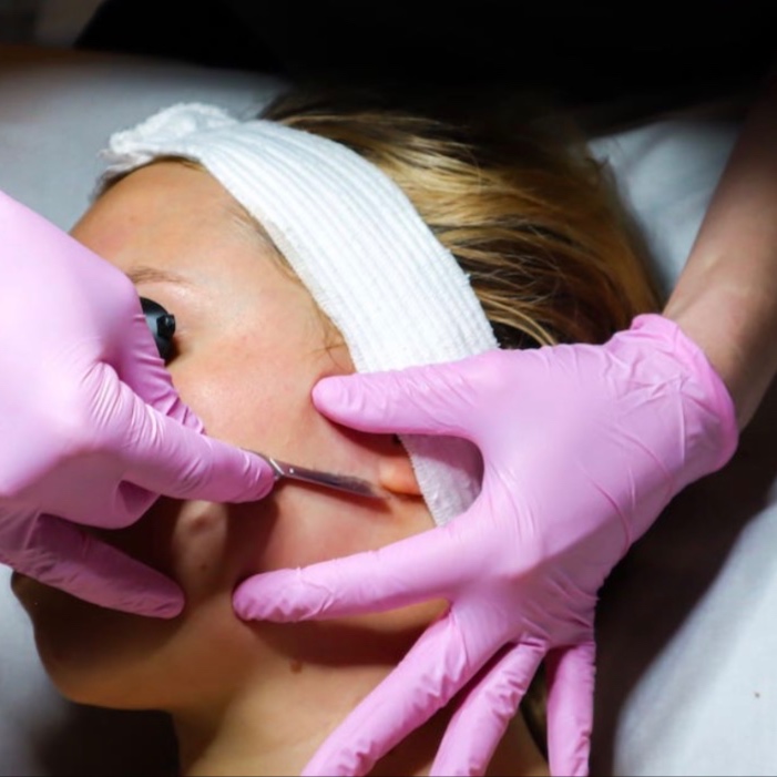 Dermaplaning at Skye Aesthetics Health Spa in Tacoma, WA