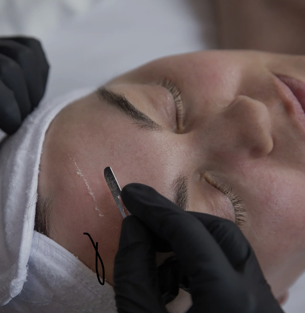Dermaplaning Facial