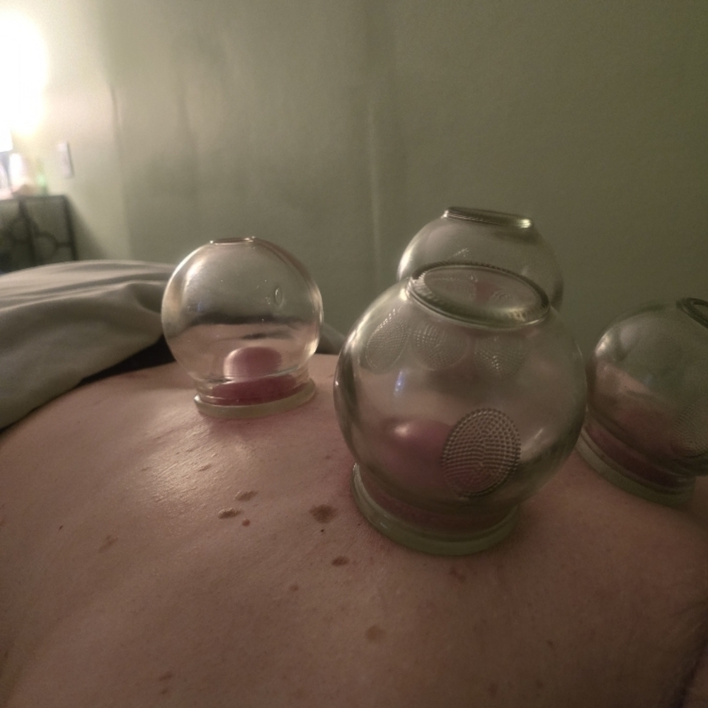 Just Cupping at The Knot Warrior Massage in Yelm, WA