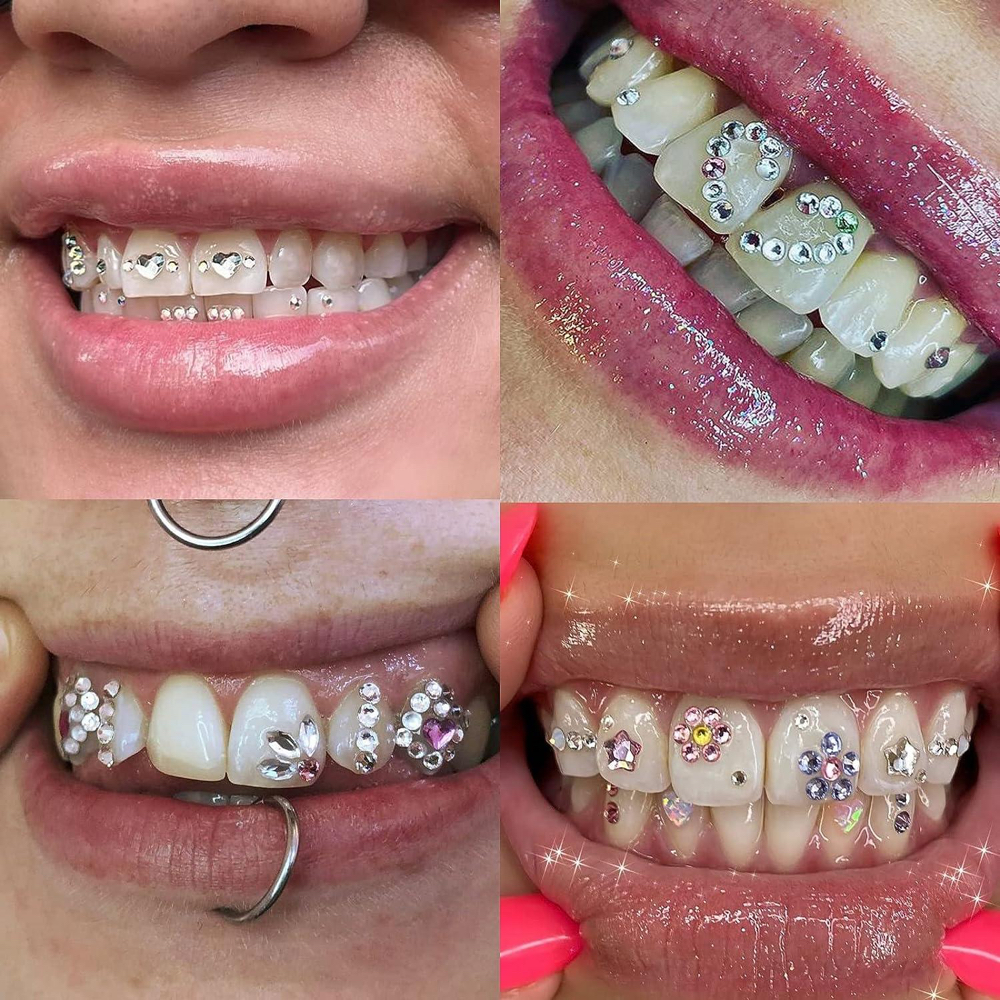 ✨Custom Tooth Gem Design at Iconic Glo Aesthetics in Loves Park, IL