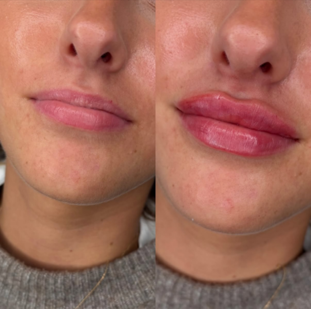 Russian/Dollfaced 1ML at Beautique J in Dorchester, MA