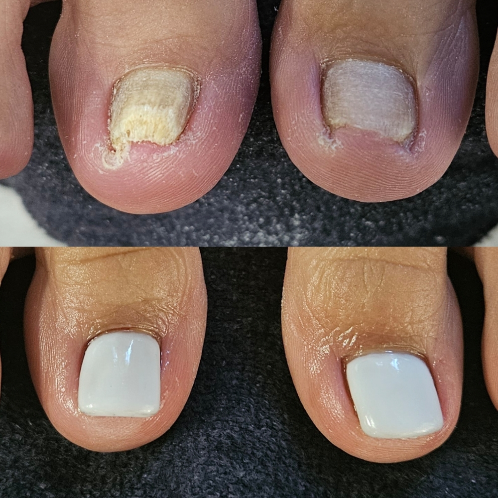 Boogie Toes