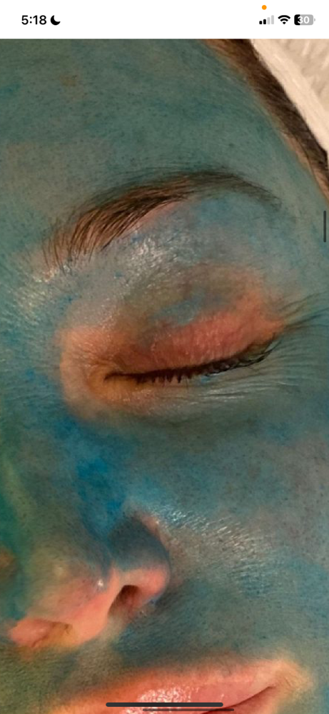The Cove Deep Blue Chemical Peel