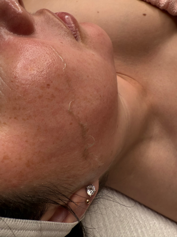SOFT TOUCH RADIANCE (DERMAPALNE)