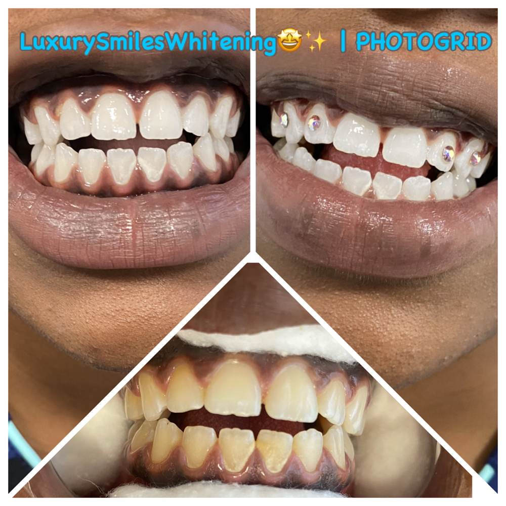 4 Tooth Gems at Luxury Smiles, Waxes & More in Dallas, TX