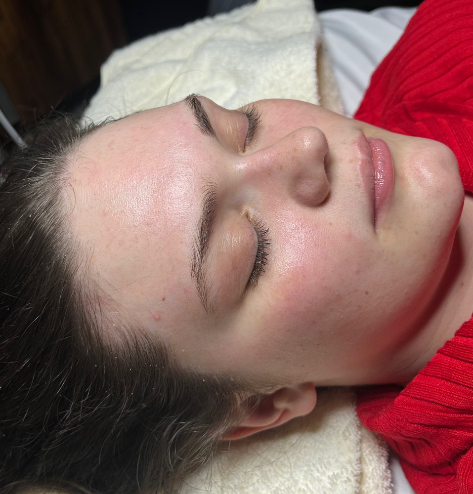 Dermaplane Add-On