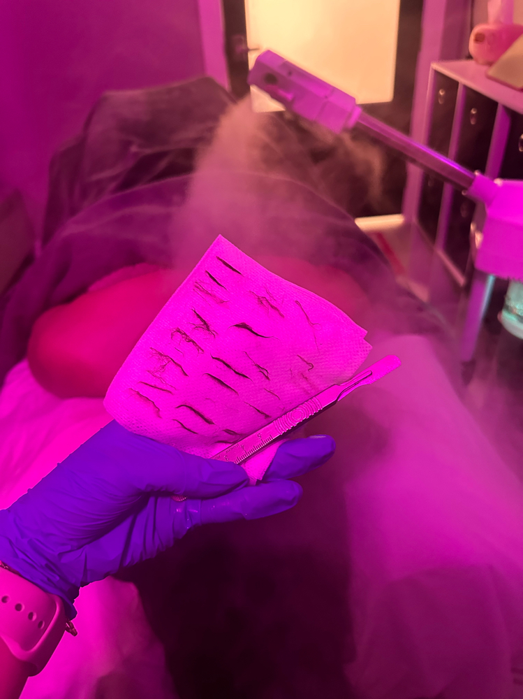 DERMAPLANE  ***ONLY***