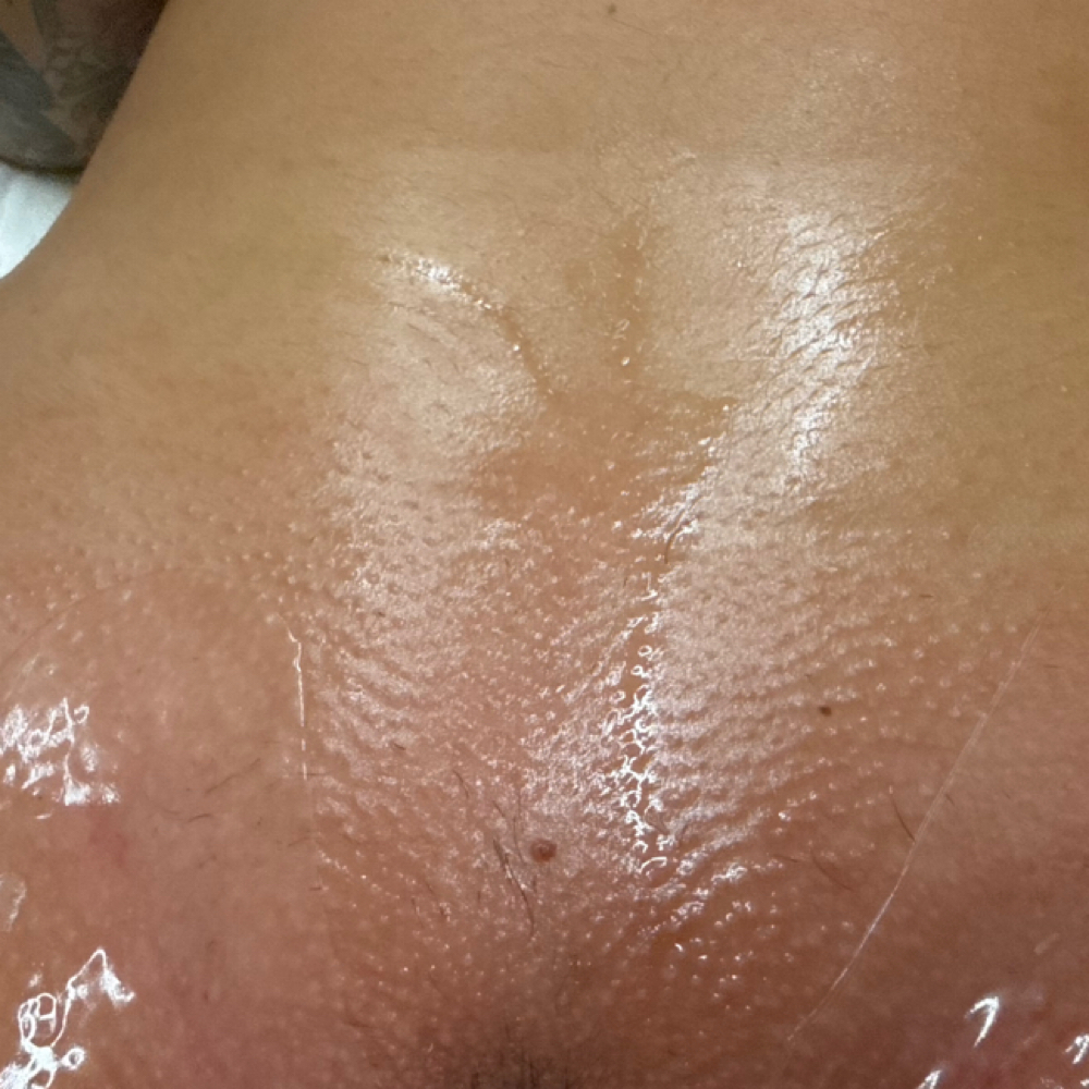 Brazilian Wax at Skin Society in Lawrence, MA