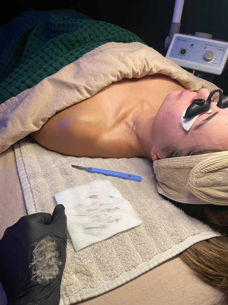 Dermaplaning Facial