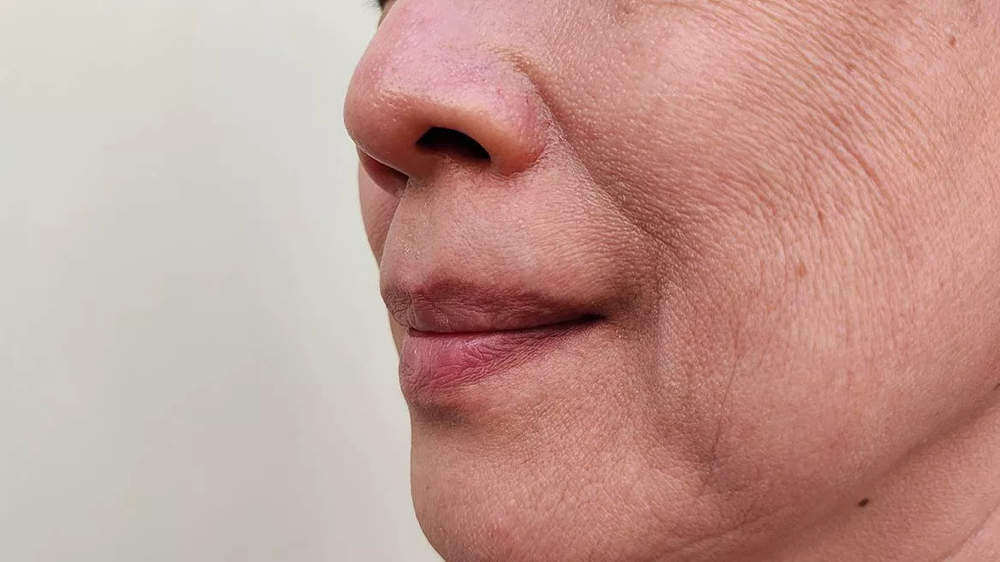 Ageless Facial