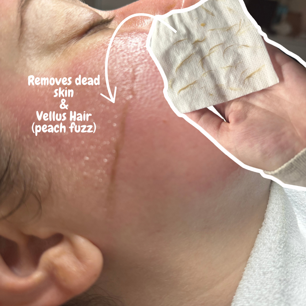 Mini Dermaplane at Gracie The Esti in Canfield, OH