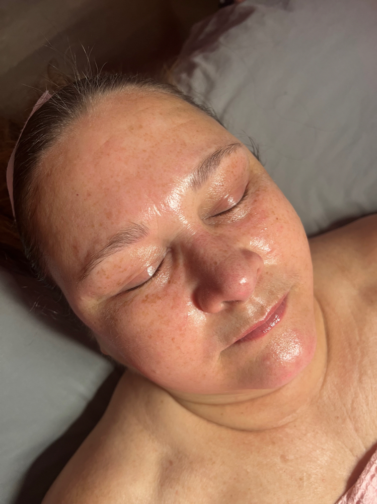 Oxygen Facial