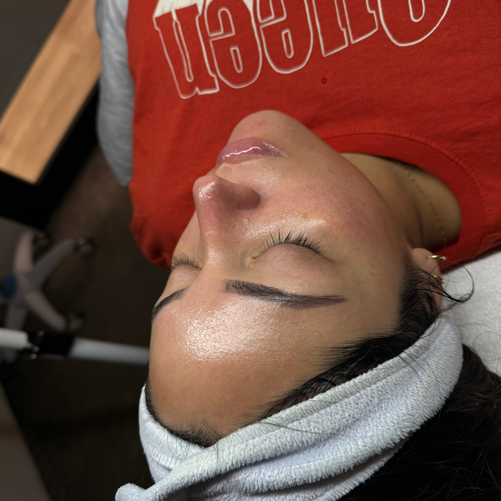 Pregnancy Facial