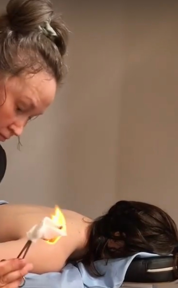 Mirai Fire Cupping & Manual Therapy