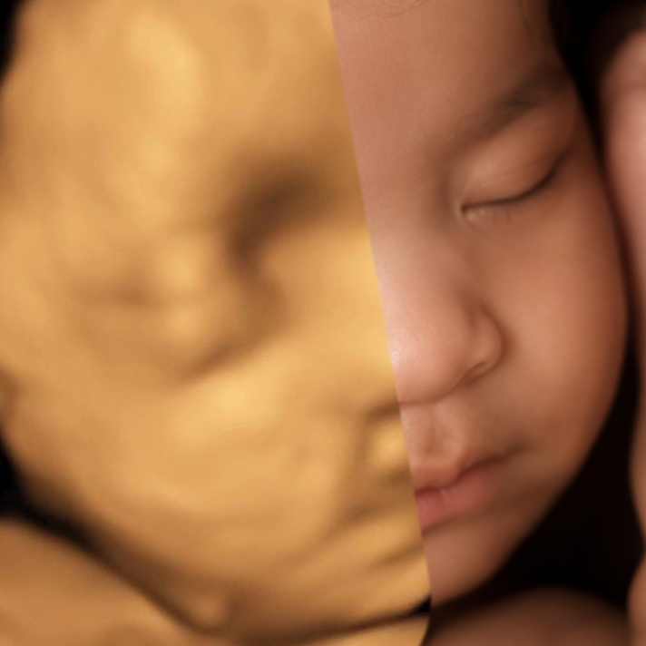 Add-On 8K Rendering at Whittier 3D 4D Ultrasound by 4D Special Delivery in Whittier, CA