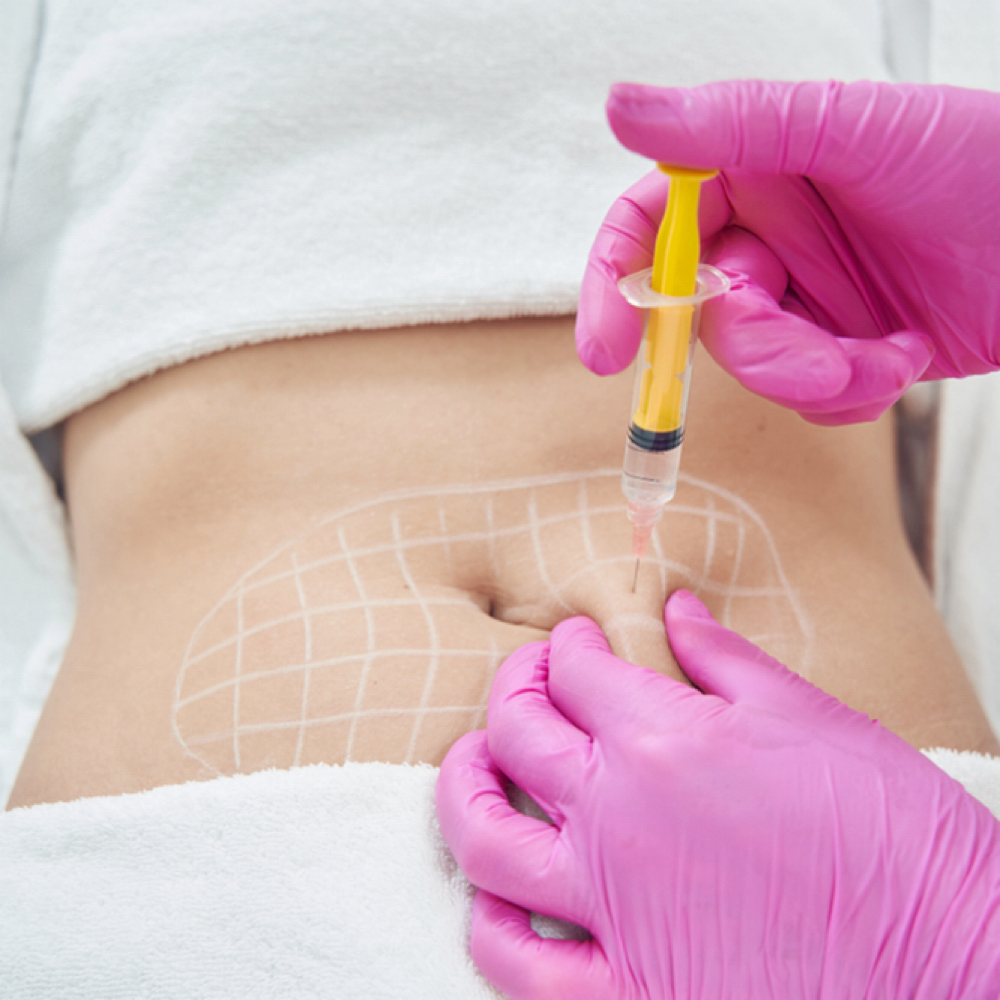 Fat Dissolving Sculpt Packages