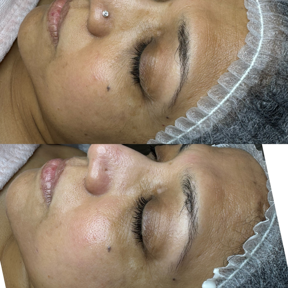 Pigment Balance Treatment at Healthy skin by Alvina in Highland Park, IL