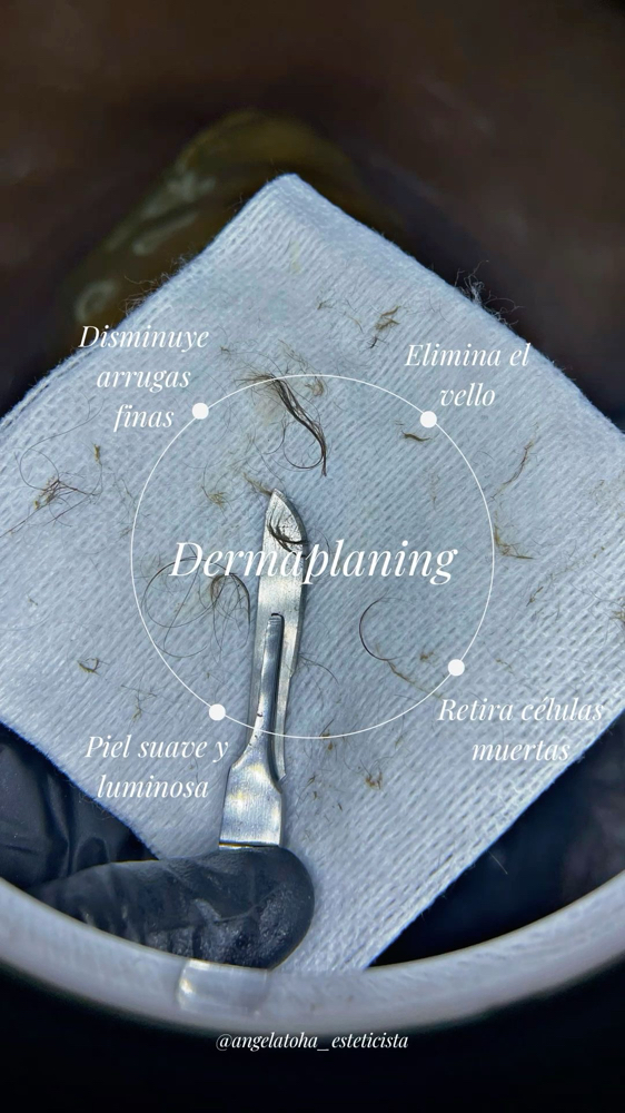 Dermaplaning Facial at Moon Massages By Beauty Glam Spa in Ansonia, CT