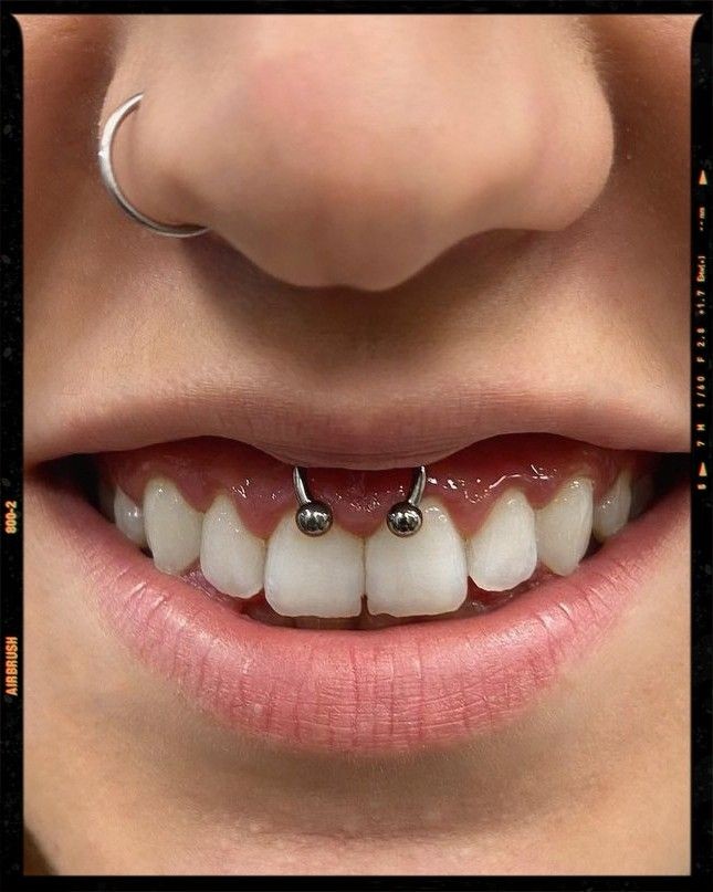 Smiley Piercing
