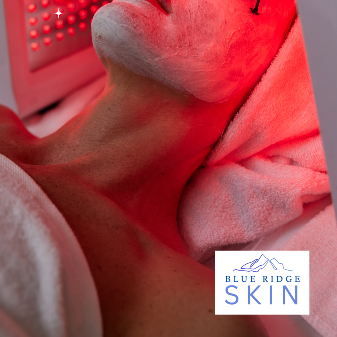 Led light therapy facial at Blue Ridge Skin in staunton, VA
