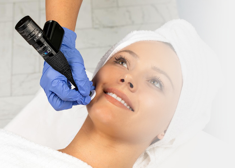 PROCELL MICROCHANNELING + BOTOX