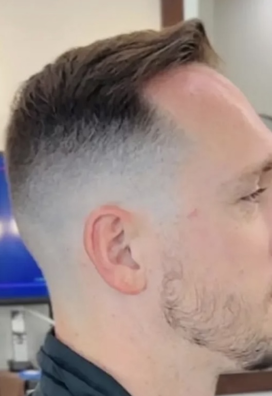 Skin Fade