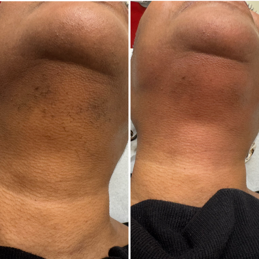 Chin at Belladz Wax Studio in Beltsville, MD