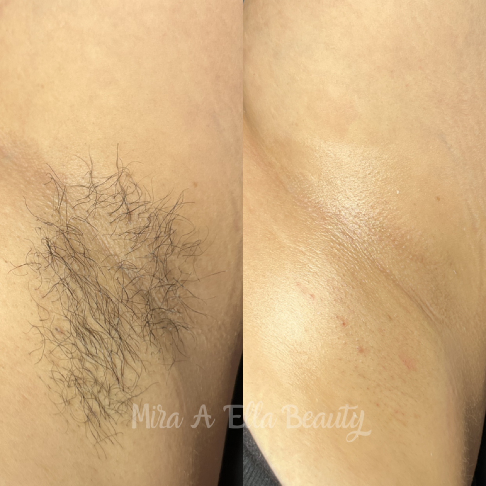 Underarm Wax at JA Beauty & Skin in Kansas City, MO