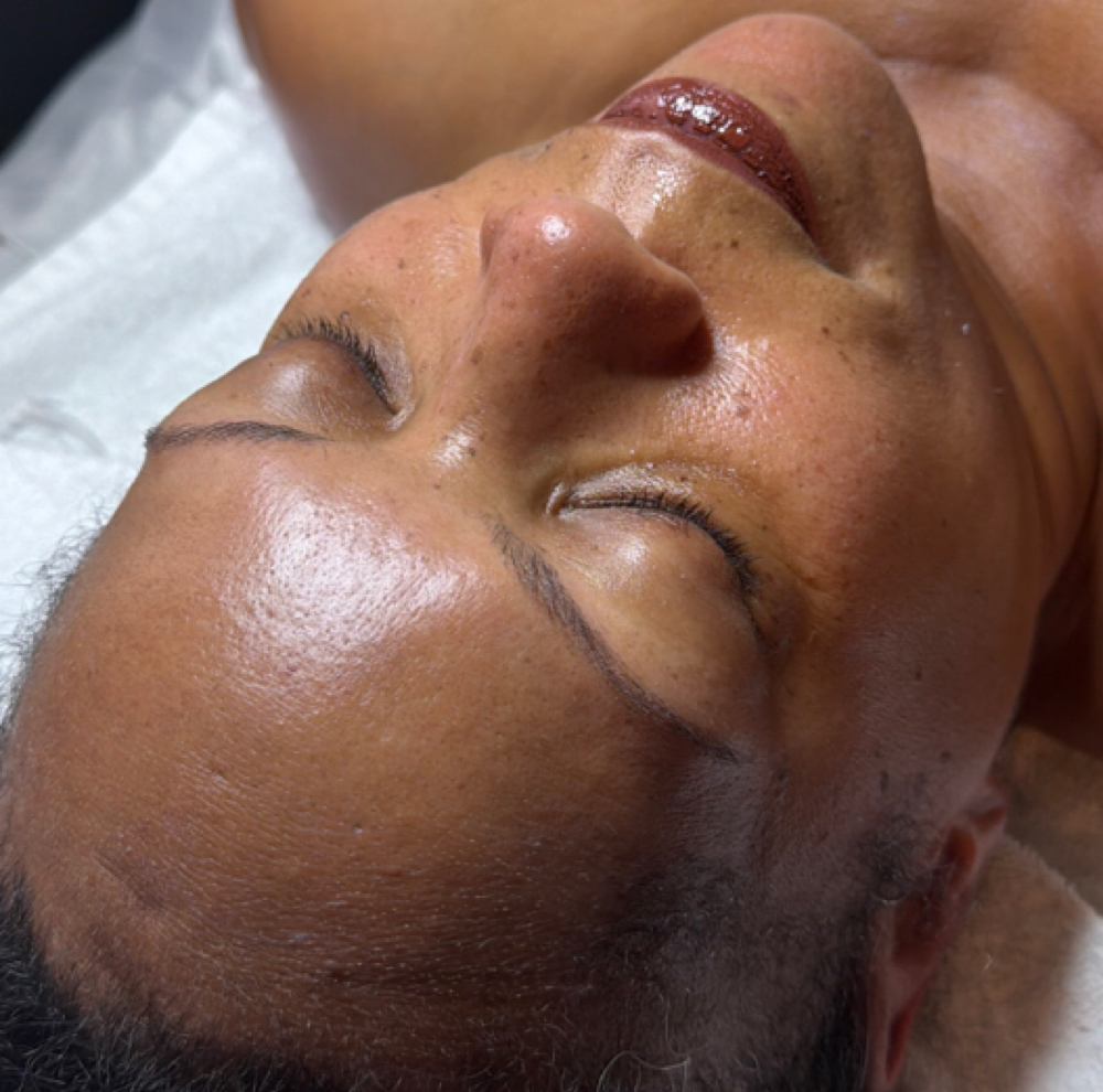 Microdermabrasion Facial at Halo & Co Esthetics in San Antonio, TX