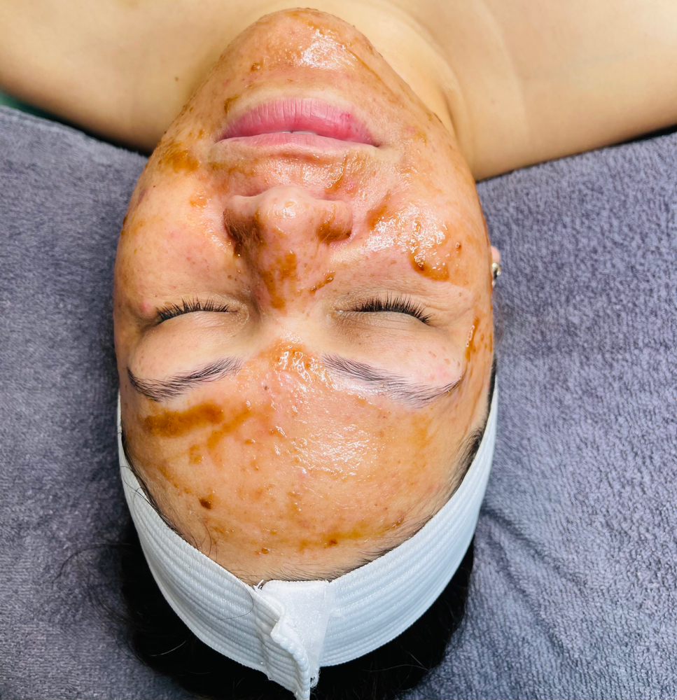 Deep Clean Facial September Special