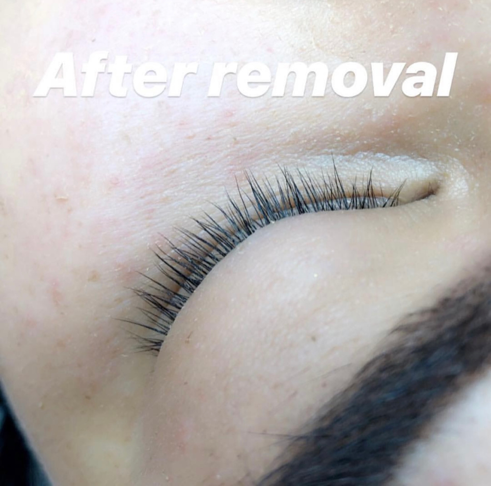 EYELASH EXTENSION REMOVAL